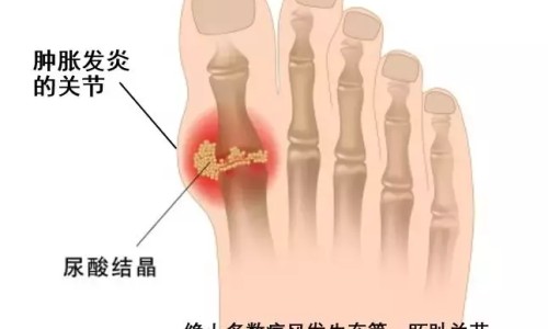 精神疾病类型及症状-各种精神疾病的症状网—知名的常见100种精神疾病有哪些网站,分享各种精神疾病的症状表现知识